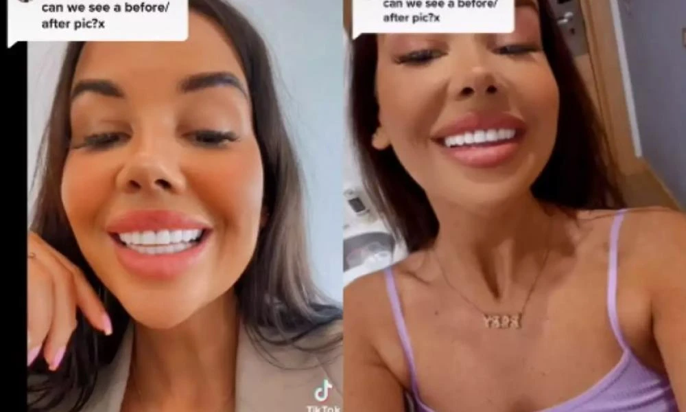 TikTok: Influencer ξόδεψε 3.500 λίρες για τα δόντια της και τώρα κινδυνεύει